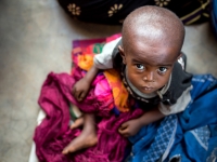 República Democrática del Congo..7.7 millones padecen hambre República Democrática del Congo..7.7 millones padecen hambre